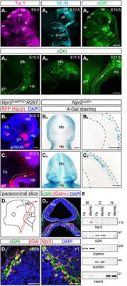 Loss of Axon Bifurcation in Mesencephalic Trigeminal Neurons Impairs the Maximal Biting Force in Npr2-Deficient Mice